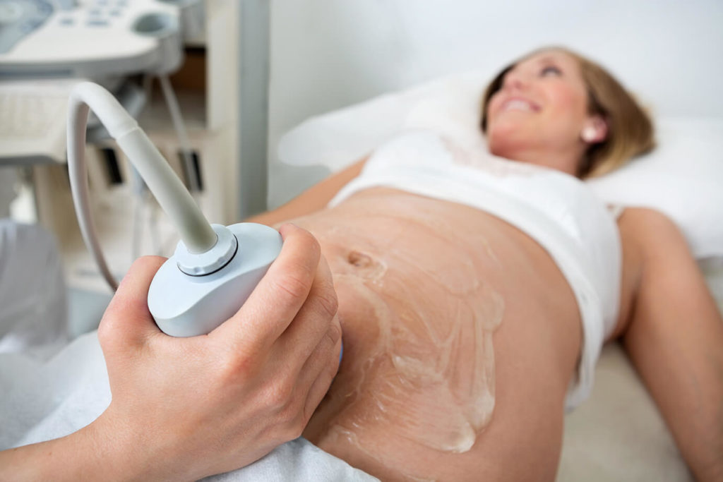woman with ultrasound gel on belly during sonogram